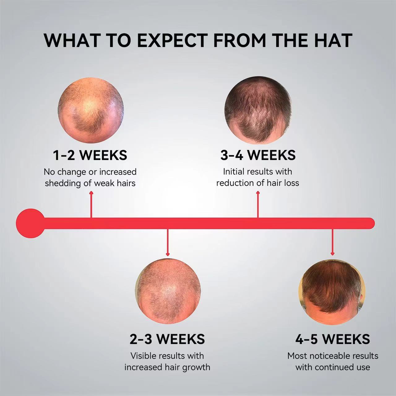 Megelin LED Laser Cap For Hair Growth